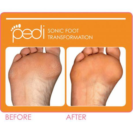 Introducing the Clarisonic Pedi System - Cosmetics Fragrance Direct