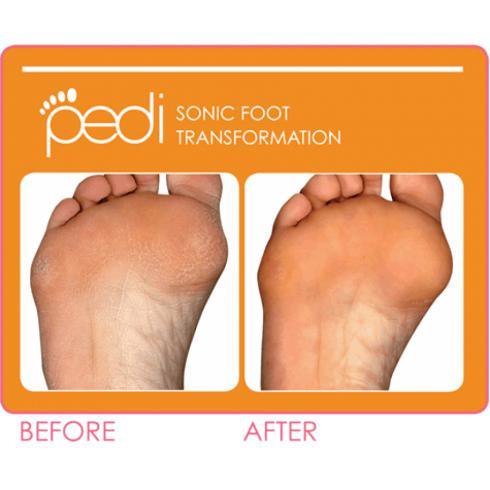 Introducing the Clarisonic Pedi System - Cosmetics Fragrance Direct